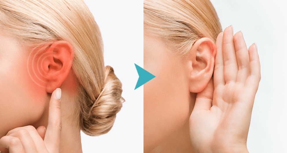 ACUSTAN DÓNDE COMPRAR